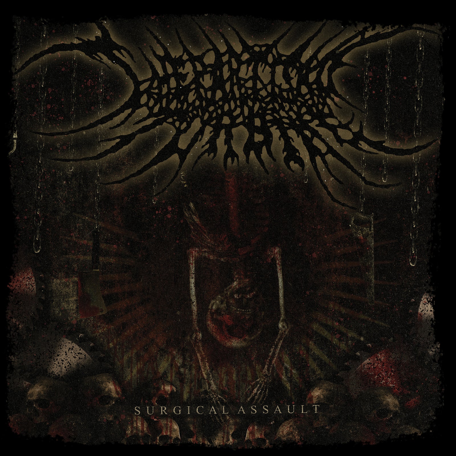 The Partisan Turbine - Surgical Assault